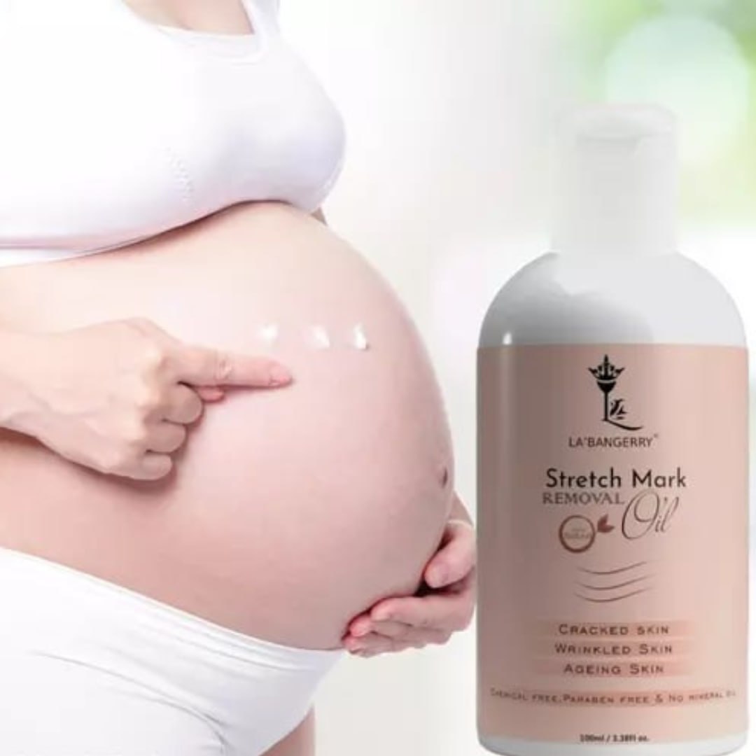 Natural Stretch Marks Removal Oil (Pack of 2)