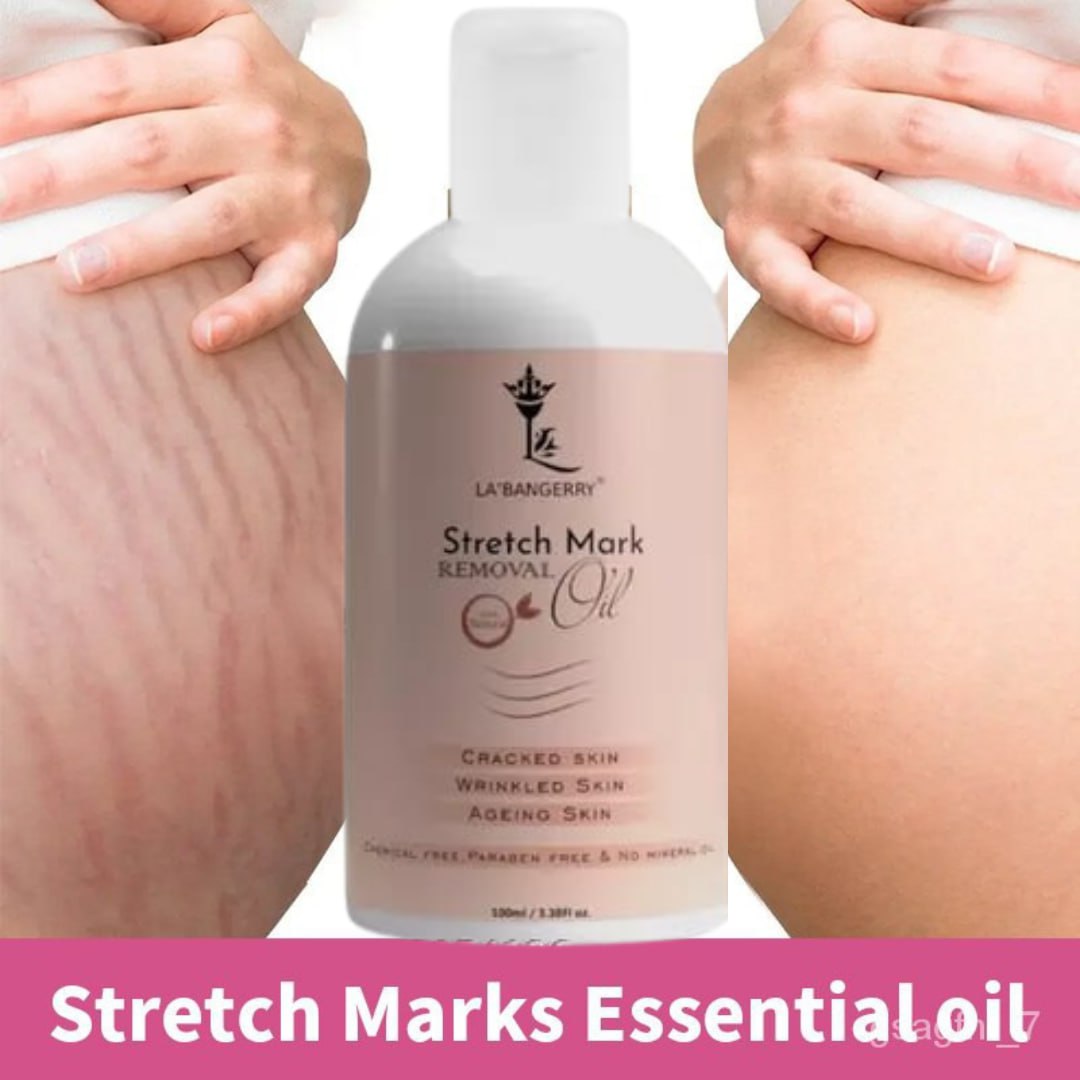 Natural Stretch Marks Removal Oil (Pack of 2)