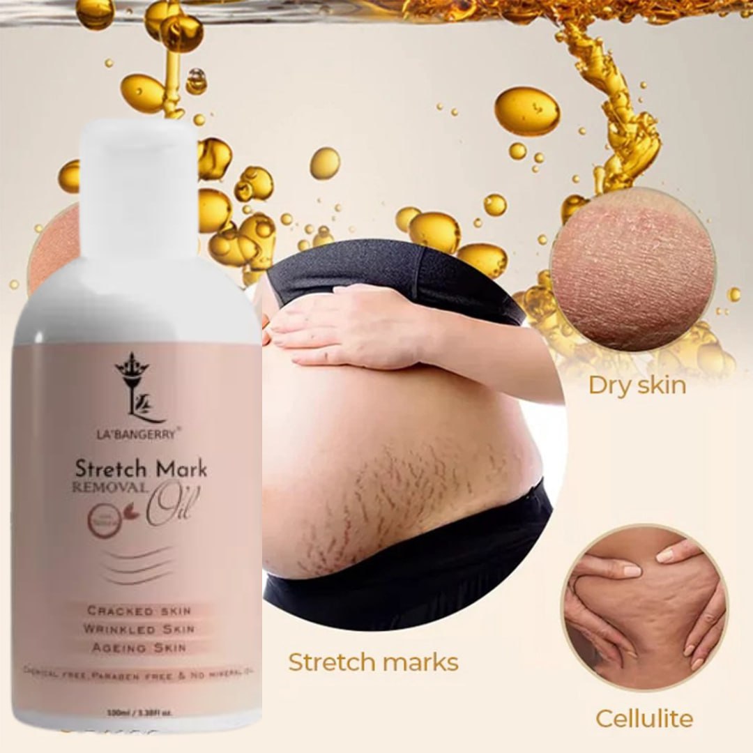 Natural Stretch Marks Removal Oil (Pack of 2)