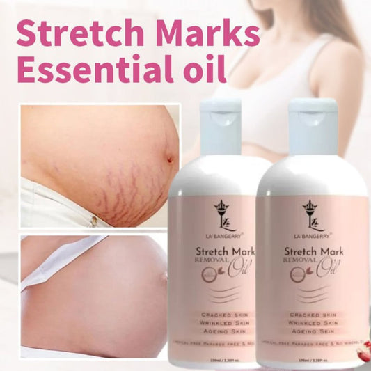 Natural Stretch Marks Removal Oil (Pack of 2)