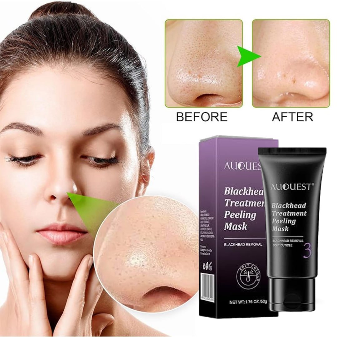 Deep Cleaning Blackhead Remover-50g