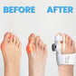 Effective Adjustable Toe Corrector