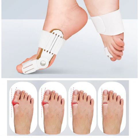 Effective Adjustable Toe Corrector